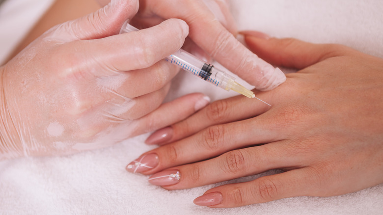 technician injecting hand with filler