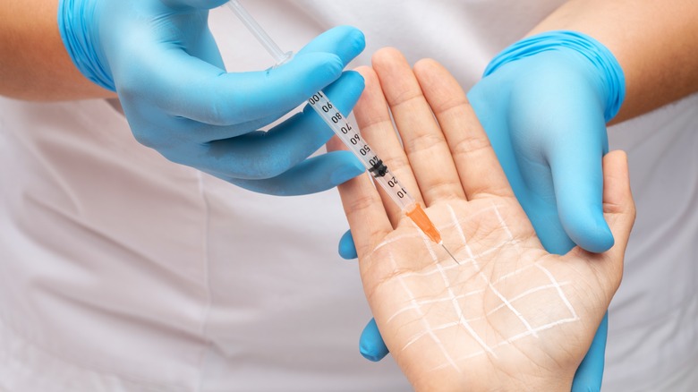 Provider injecting Botox into palm of patient with hyperhidrosis