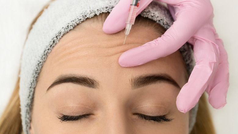 forehead lines injection treatment