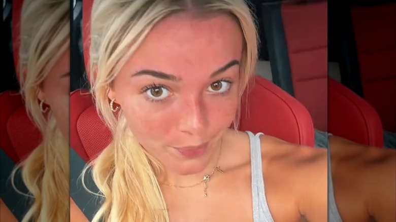 Olivia Dunne in her car with a reddened face