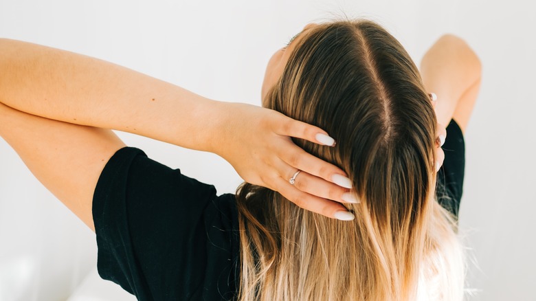 woman showing her scalp