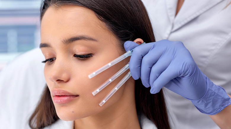 Female patient before receiving thread lift procedure