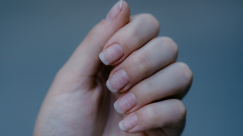 thin brittle nails