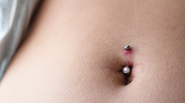 Infected belly button piercing