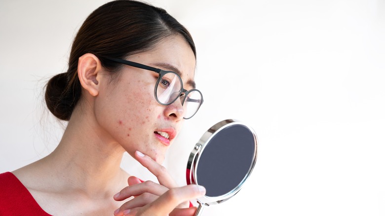 Woman looking at acne in mirror