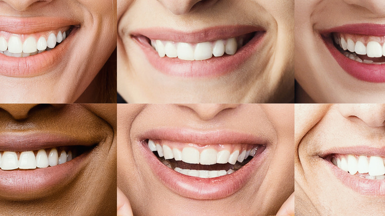 A collage of various smiling mouths showing white teeth.