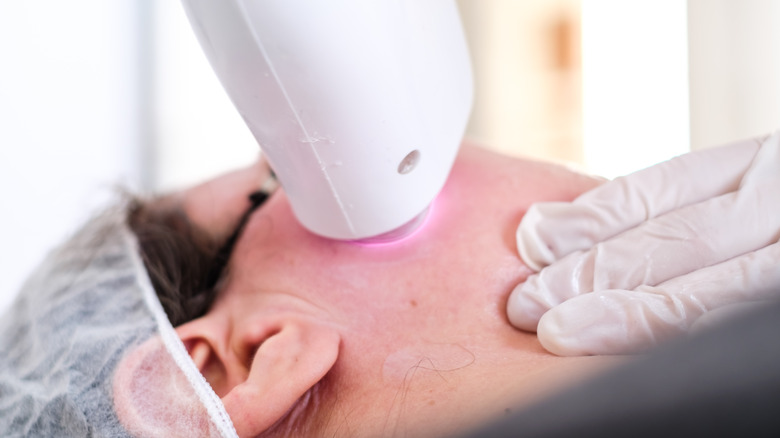 A woman getting a laser facial