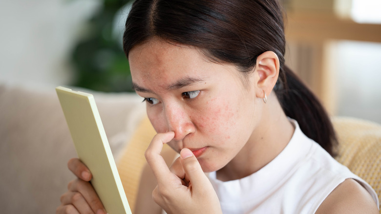 Woman with acne-prone skin.