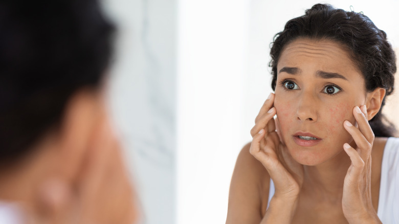 Woman with acne looking in mirror