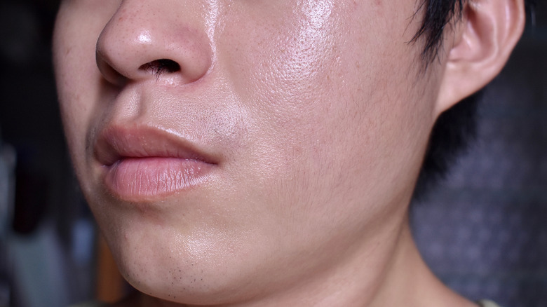 asian man with large pores and oily skin