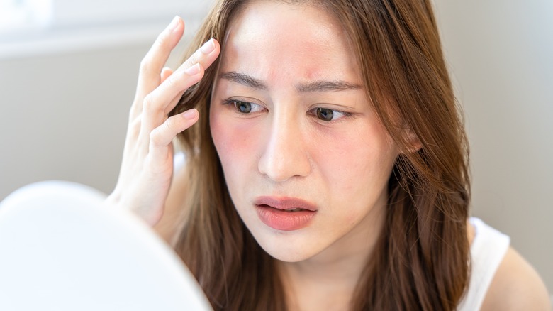 woman worried about sensitive reddened skin