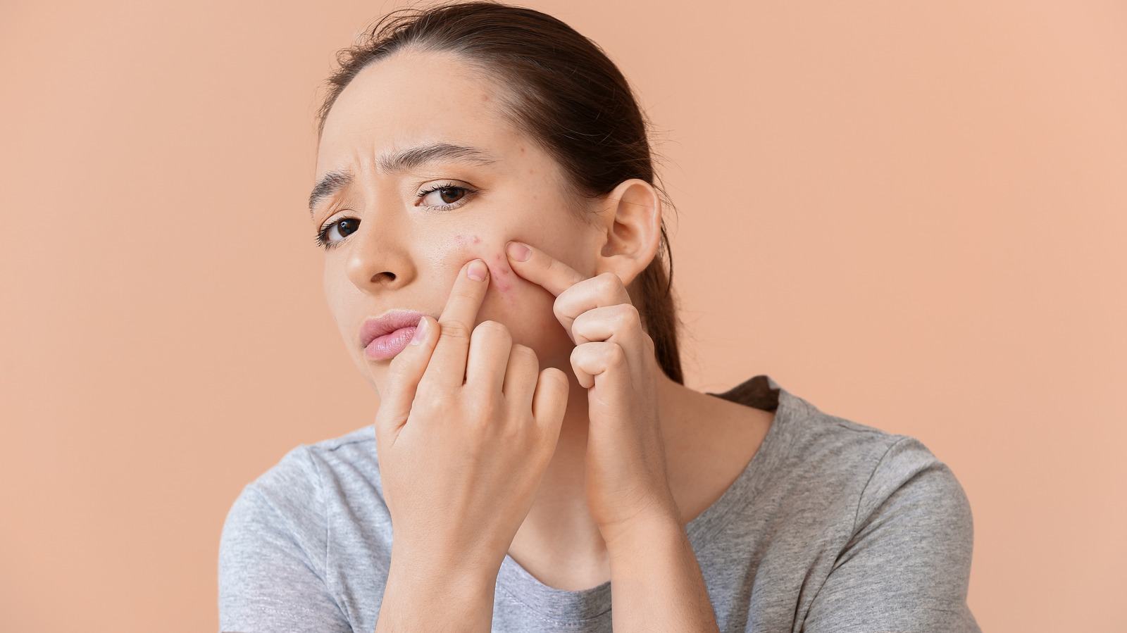 How To Tell The Difference Between Hormonal And Bacterial Acne