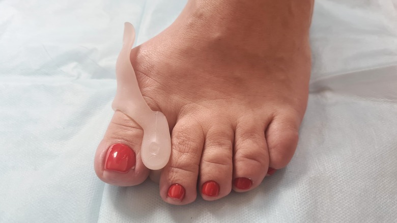 toe separators