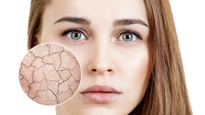 woman with dry skin circle