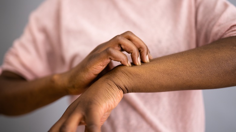 person scratching irritated skin