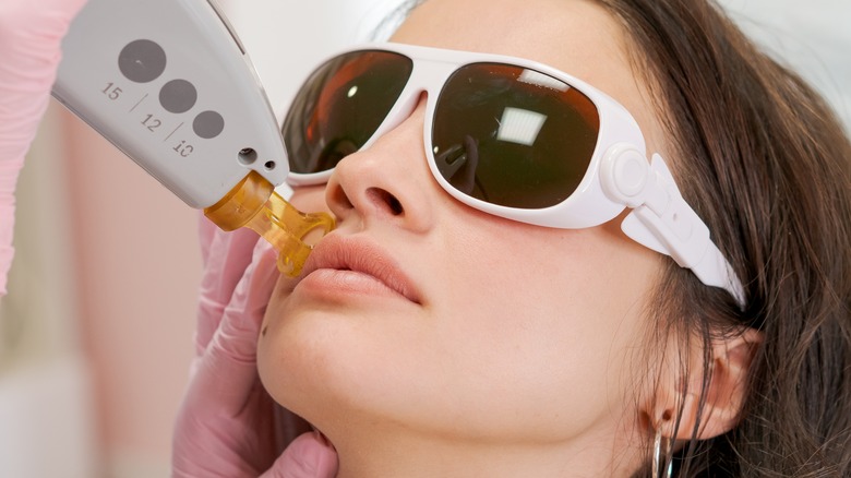 skin laser treatment