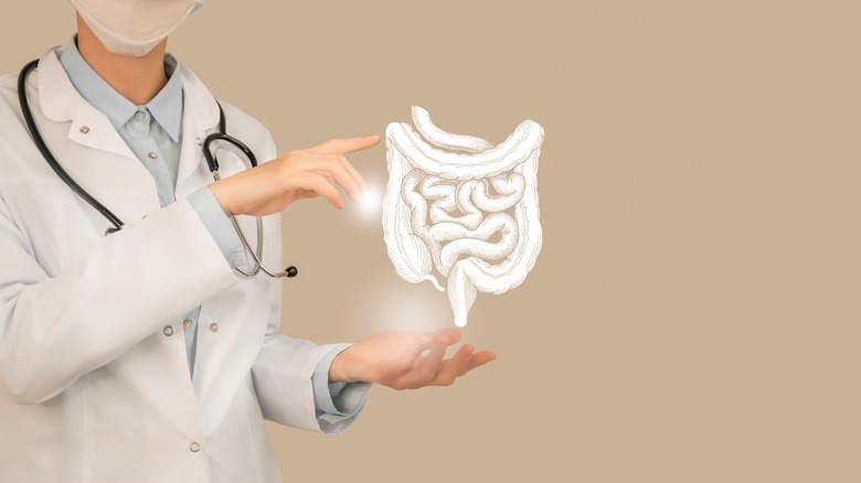 doctor holding diagram of intestines