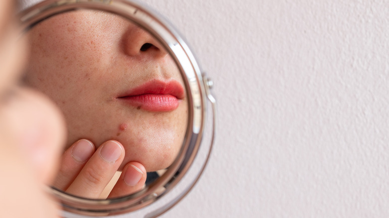 woman looking at pimple in mirror