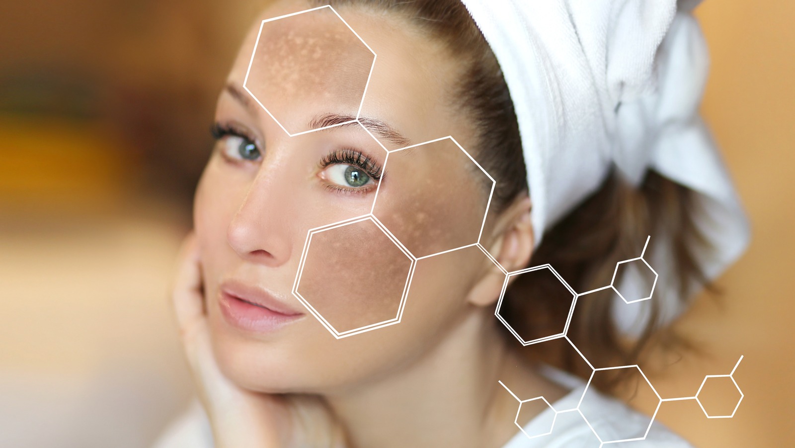 Inside The Three Types Of Hyperpigmentation