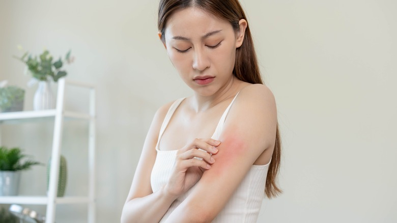 Woman scratching her arm