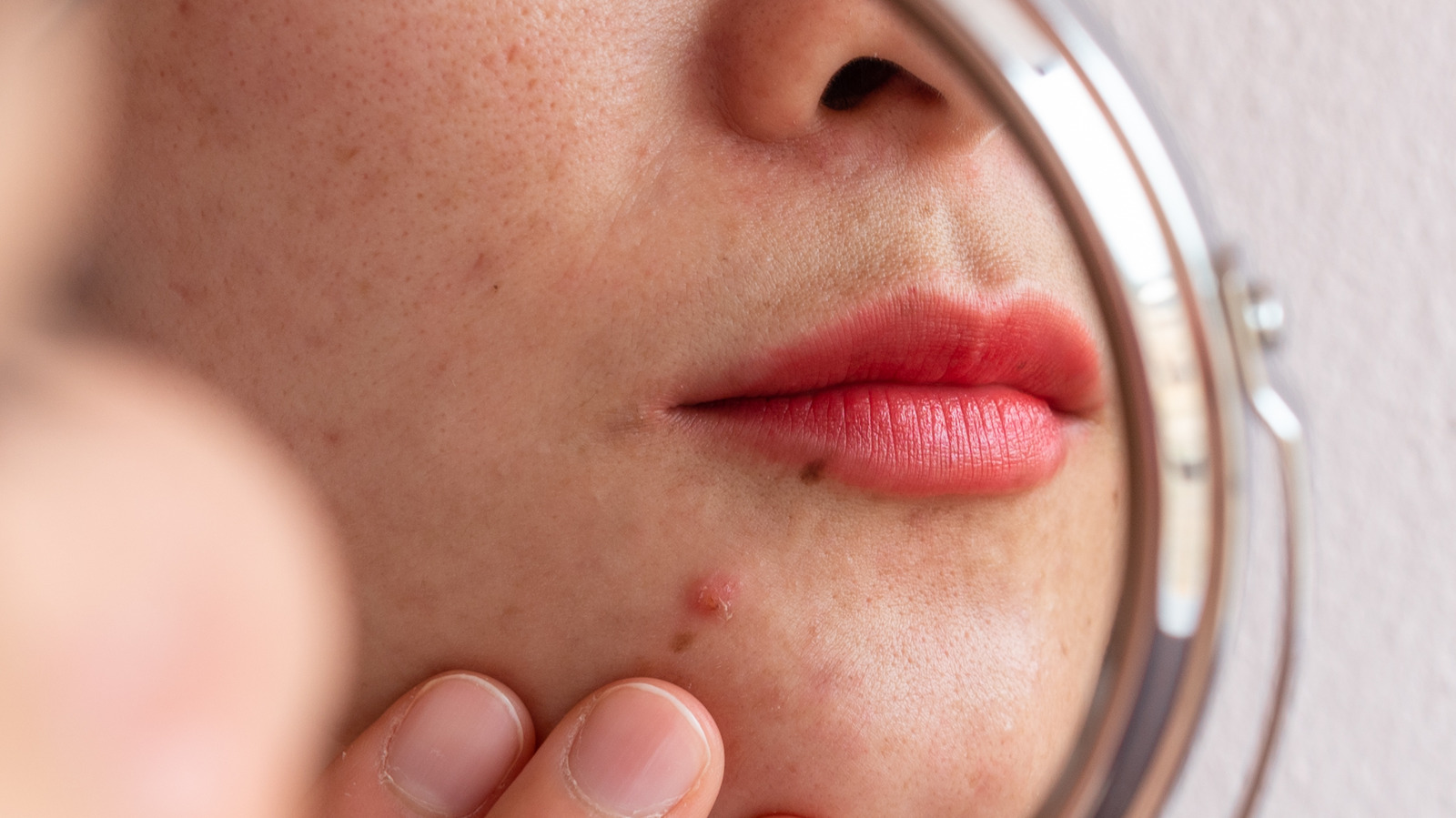 Is Neosporin An Effective Acne Treatment 