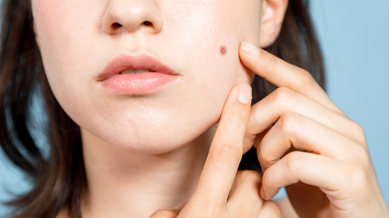 womans face mole check