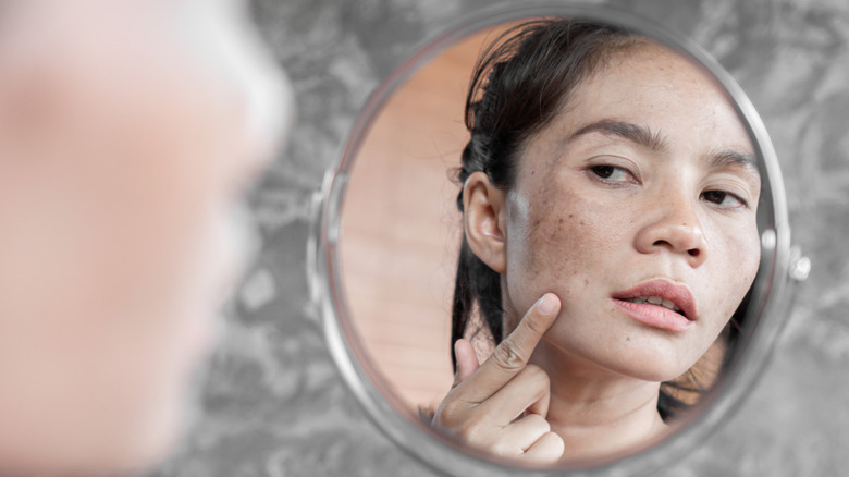 woman assessing her hyperpigmentation