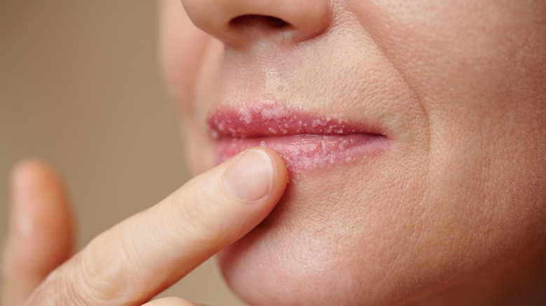 Woman exfoliating her lips