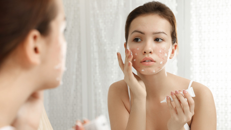 woman applying lotion to acne