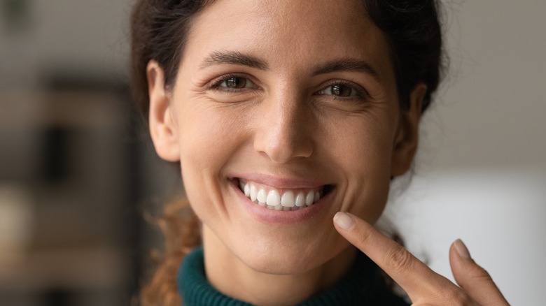 woman smiling with veneer teeth