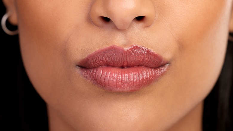 woman with lip filler