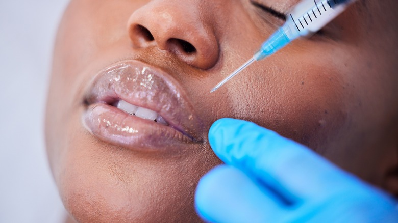 A woman getting lip filler