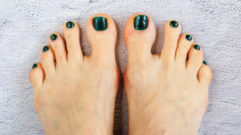 A dark green pedicure