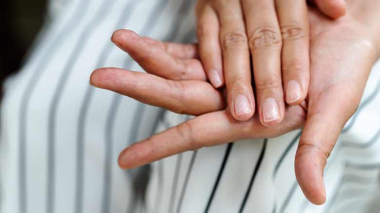 splitting nails on hand