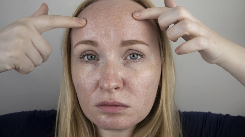 woman touching oily skin