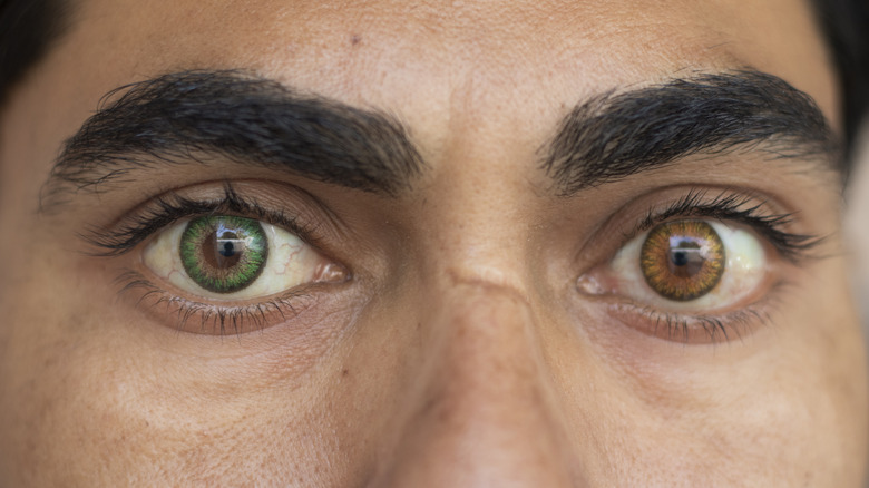 A person with one green and one brown eye