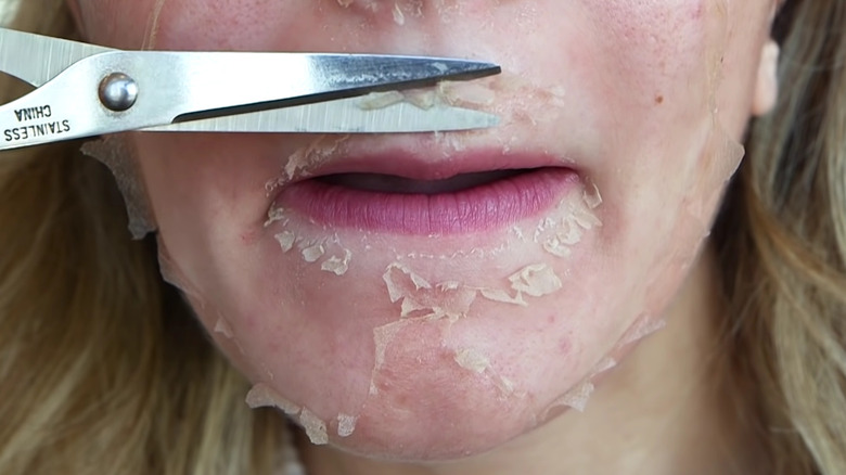 woman cutting off peeling skin