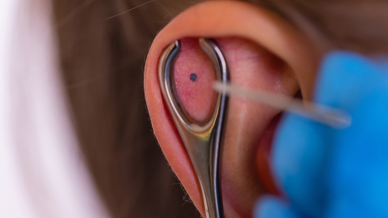 Needle piercing cartilage