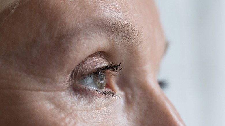 woman with crow's feet wrinkles