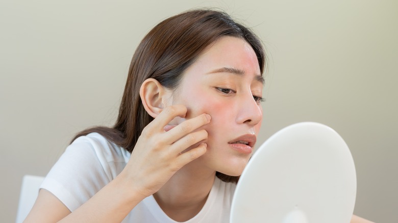 Woman with reddened, irritated skin 