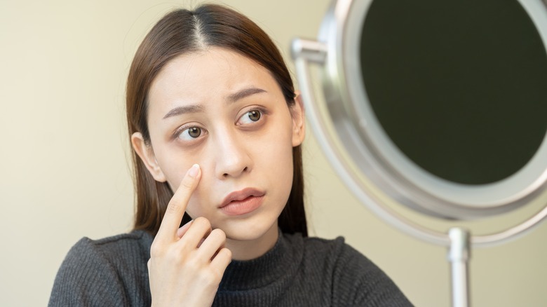 Young woman with puffy eye circles