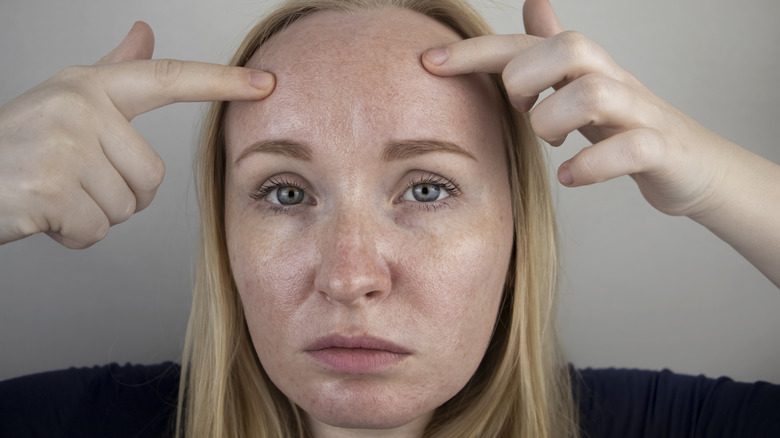 A woman examining age spots