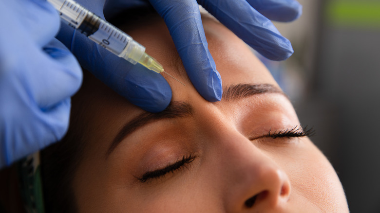 facial dermal filler injection