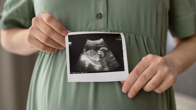 woman holding pregnancy ultrasound photo