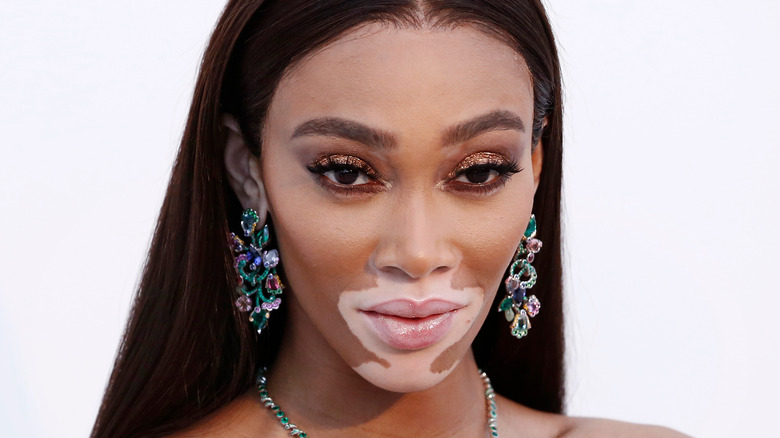 Winnie Harlow