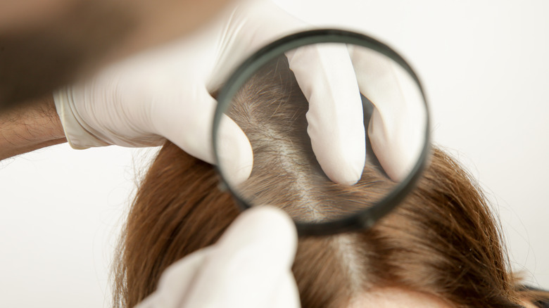 Doctor examining scalp