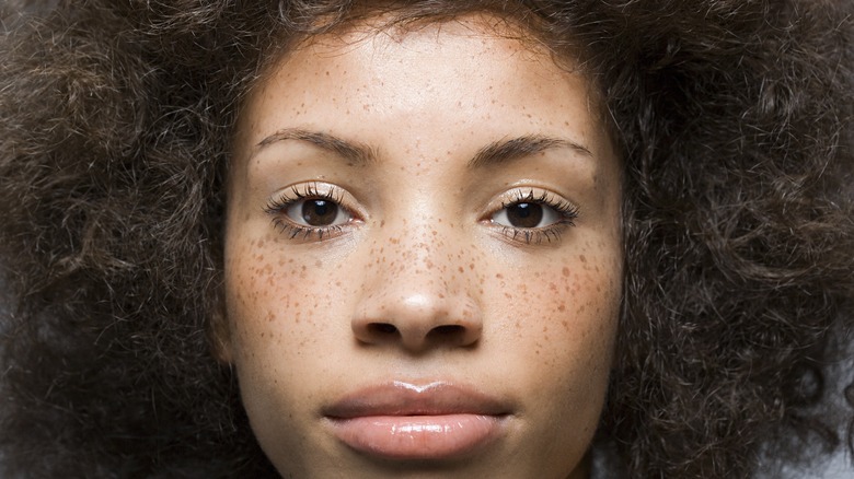 woman with freckles on face