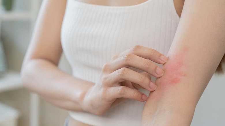woman scratching rash