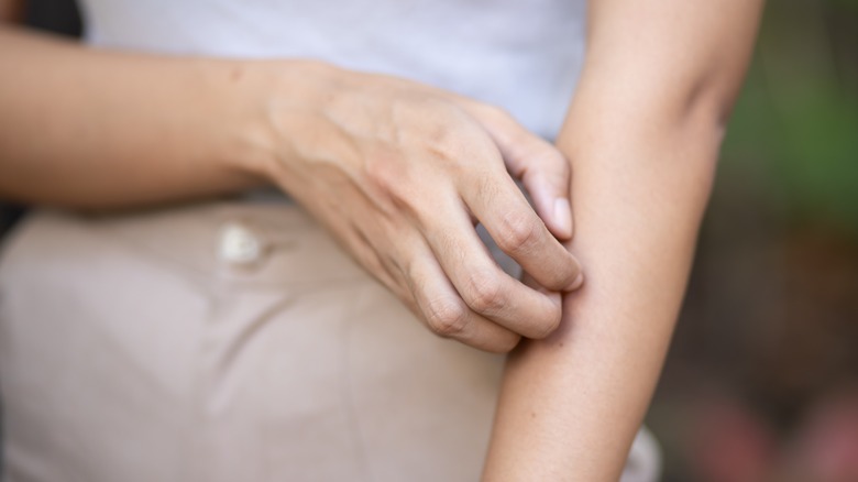 Woman scratching her arm