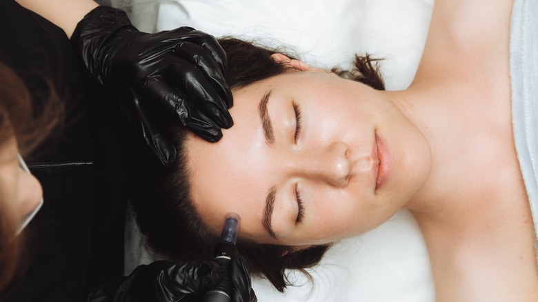 woman microneedling session